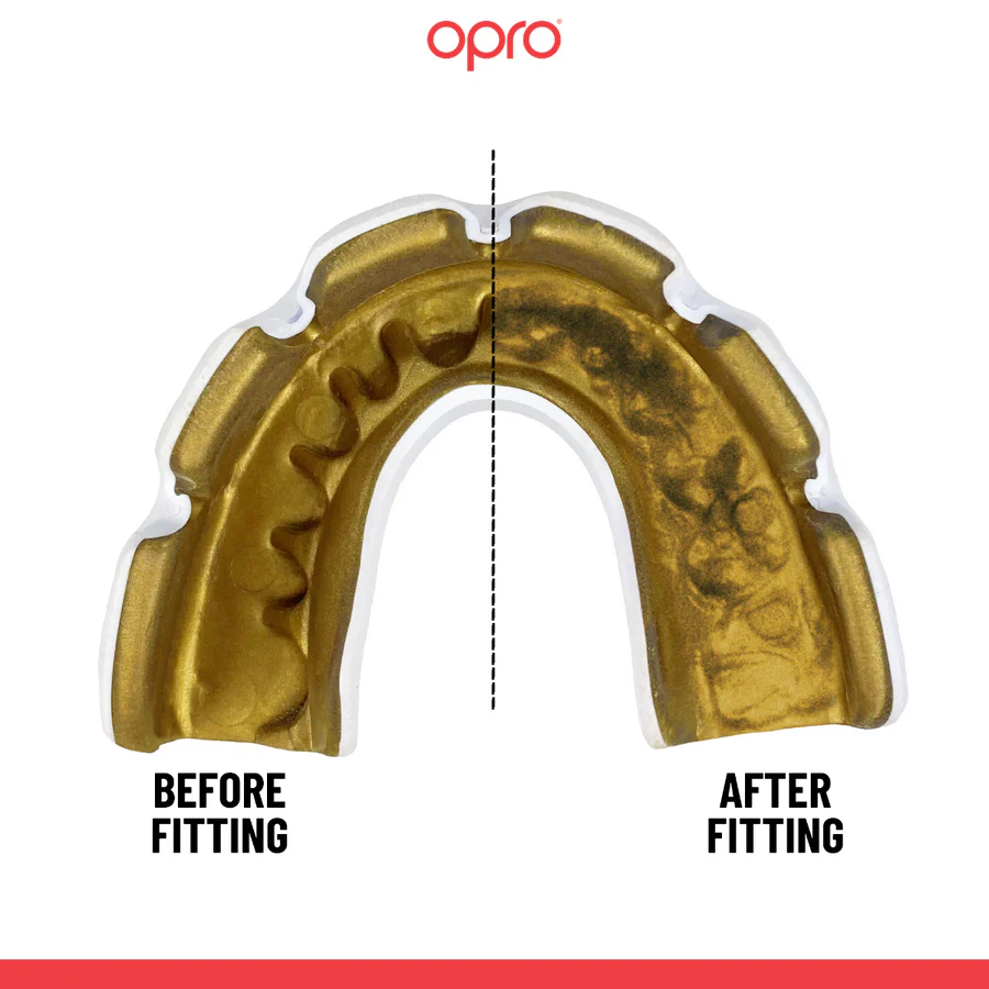 Protège-dents Opro Instant Custom-Fit pour appareil Blanc-or  - Image 2