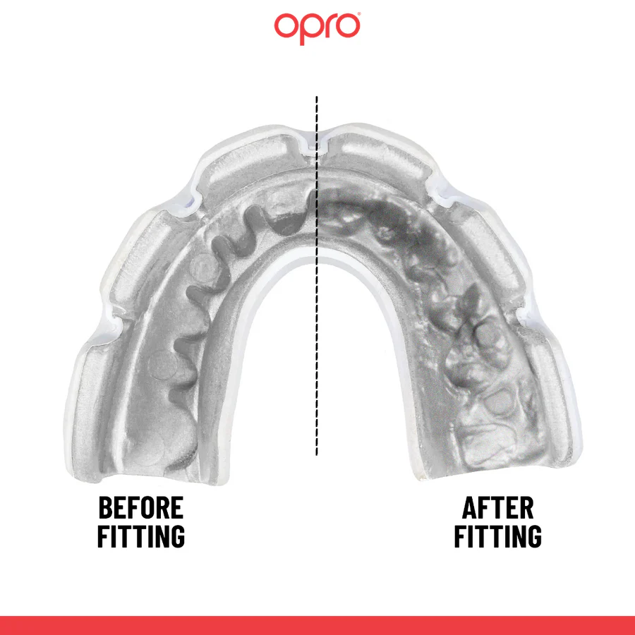 Protège-dents Opro Instant Custom-Fit pour appareil Noir-blanc  - Image 2